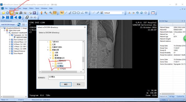 MicroDicom viewer(Dicomʽͼ)