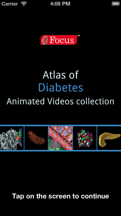 Animated Atlas of Diabetesͼ0