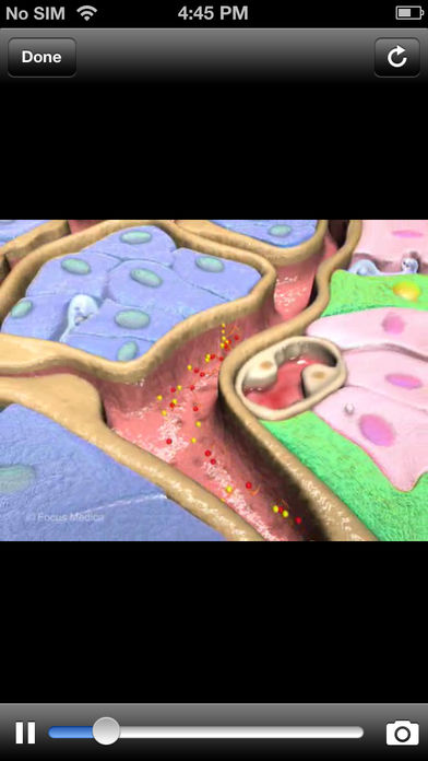 Animated Atlas of Diabetesͼ2